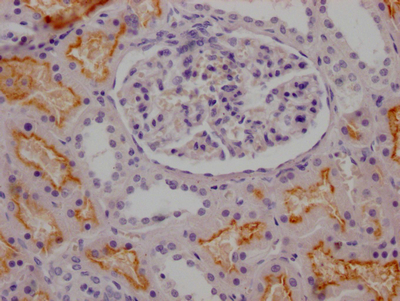 ACE Antibody