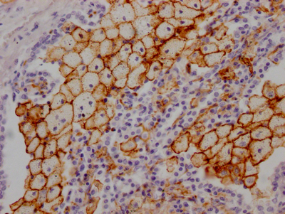 ACE Antibody
