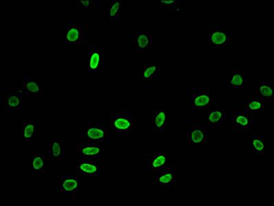 Acetyl-HIST1H3A (K23) Antibody