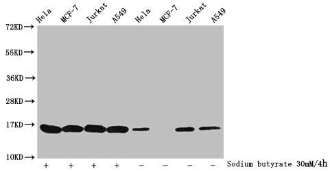 Acetyl-HIST1H3A (K27) Antibody