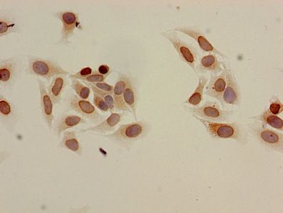 Acetyl-HIST1H3A (K9) Antibody