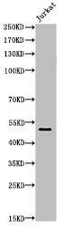 FOXA1 Antibody