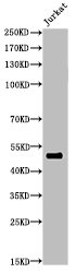 FOXA1 Antibody