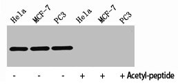 HIST1H4A Antibody