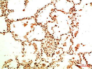 Acetyl-RELA(K314/K315) Antibody