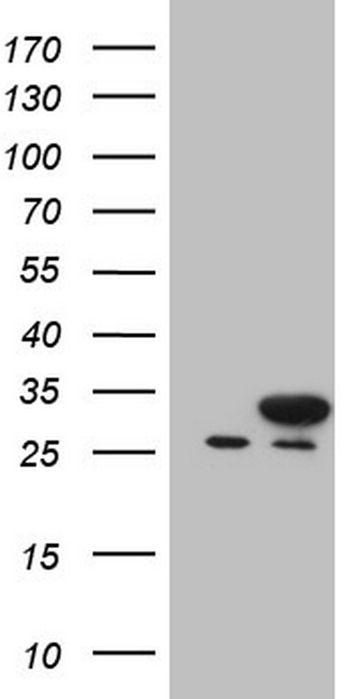 SMPD1 Antibody