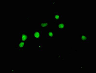 ACLY Antibody