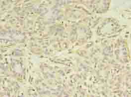 ACLY Antibody