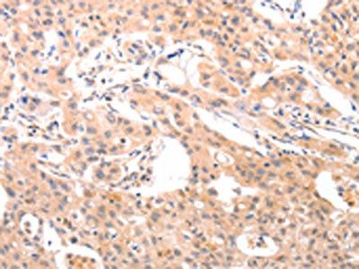 ACO1 Antibody