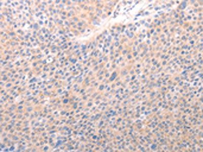 ACO1 Antibody
