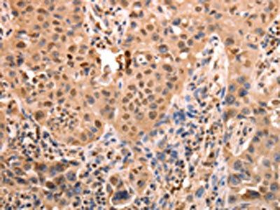 ACO2 Antibody