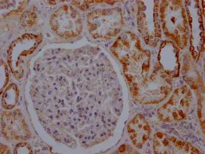 ACO2 Antibody