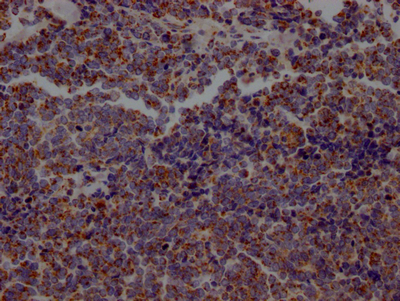 ACO2 Antibody