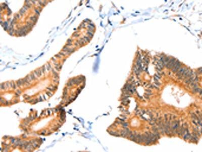 ACOX3 Antibody