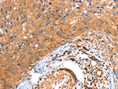 ACOX3 Antibody