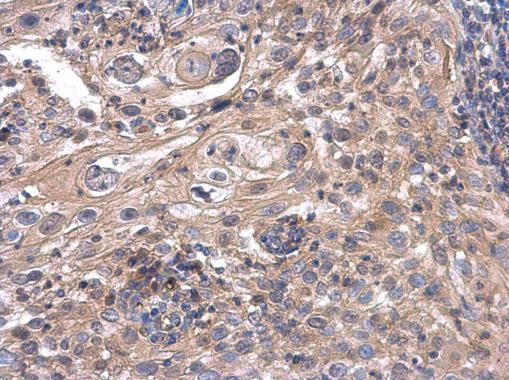 ACOX3 Rabbit Polyclonal Antibody
