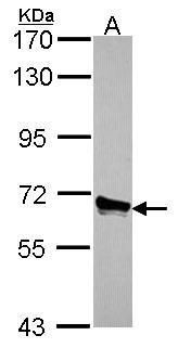 ACOX3 Rabbit Polyclonal Antibody