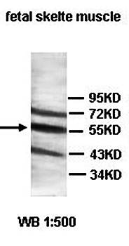 ACPL2 Rabbit Polyclonal Antibody