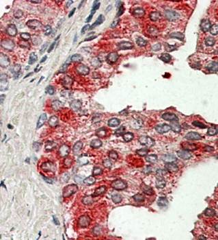 ACPP/PAP Antibody