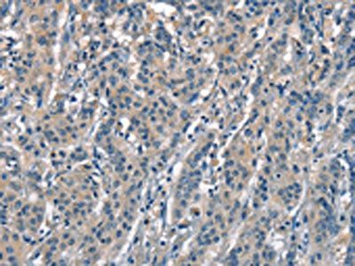 ACP4 Antibody