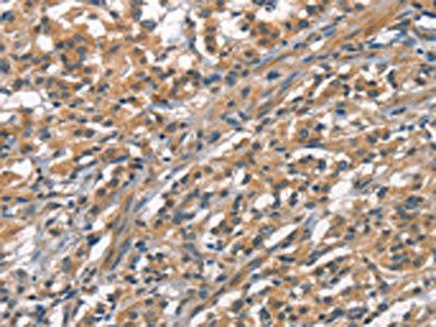 ACP4 Antibody