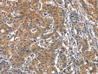 ACP4 Antibody