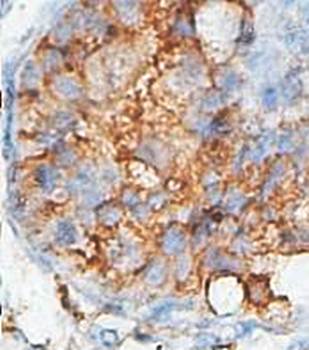 ACPT Rabbit Polyclonal Antibody