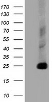 ACSBG1 Antibody