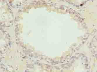 ACSBG1 Antibody