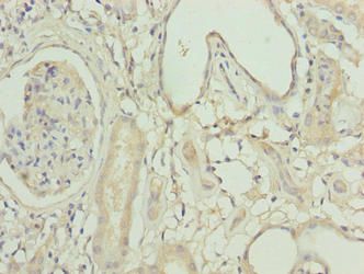 ACSBG1 Antibody