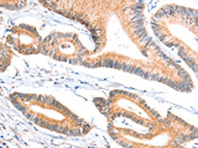 ACSBG1 Antibody