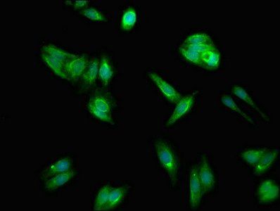 ACSL1 Antibody