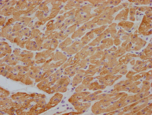 ACTB/POTEKP/ACTG1 Antibody