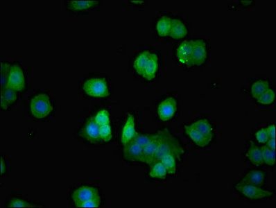 ARPC3 Antibody