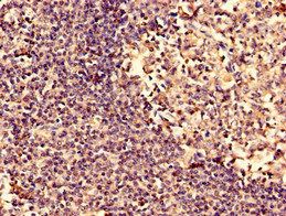 ARPC3 Antibody