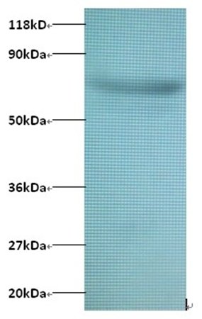 ARPC3 Antibody (Biotin)