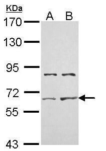 NAT2 Rabbit Polyclonal Antibody