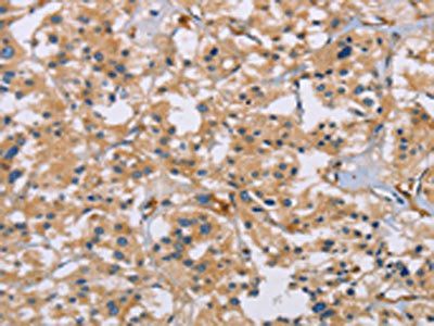 ACTN4 Antibody