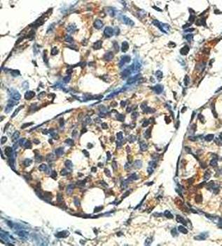 ACTRT2 Rabbit Polyclonal Antibody