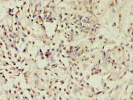 ACVR2B Antibody