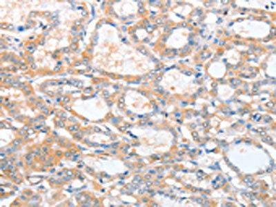 ACY3 Antibody