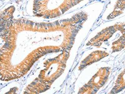 ACY3 Antibody