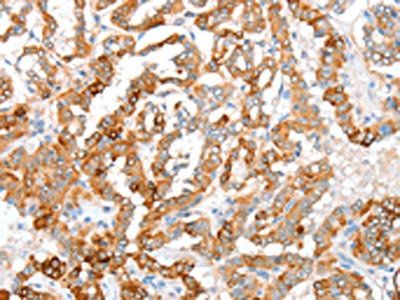 ACY3 Antibody