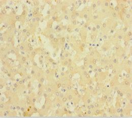 DBI Antibody