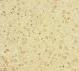DBI Antibody