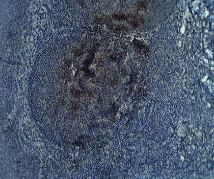 Rabbit anti Human ADAM DEC1 Antibody