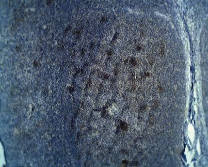 Rabbit anti Human ADAM DEC1 Antibody