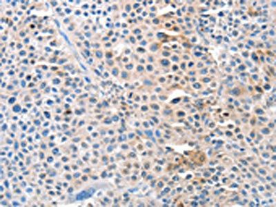 ADAM10 Antibody