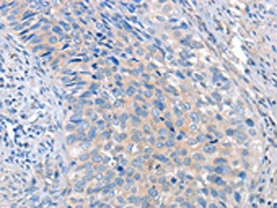 ADAM10 Antibody