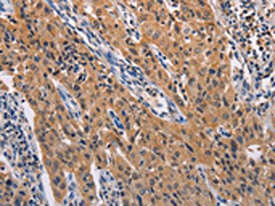 ADAMDEC1 Antibody